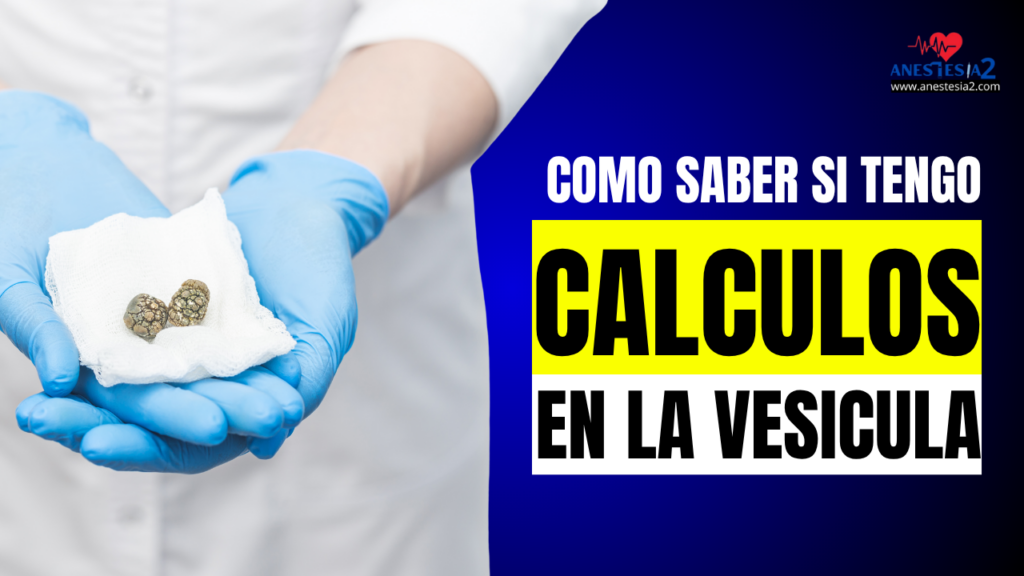 como saber si tengo calculos en la vesicula