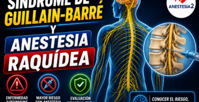 anestesia y sindrome de guillain barre